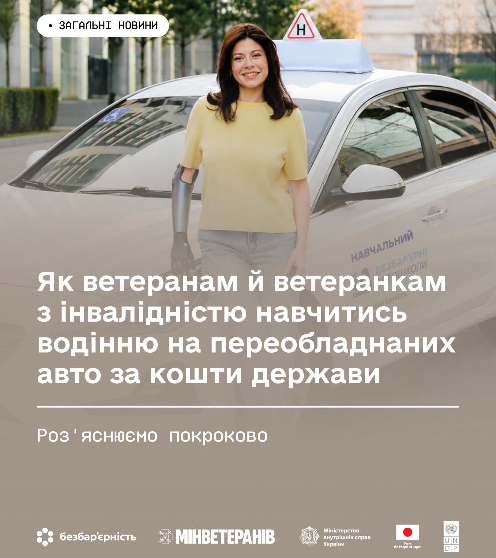 На фото жінка на руці якої протез